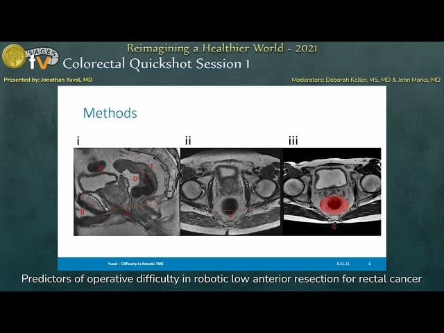 Predictors of operative difficulty in robotic low anterior resection for rectal cancer