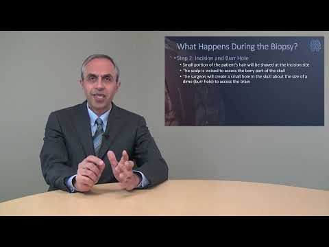 Thumbnail for What is the Stereotactic Brain Biopsy Procedure? - Aaron Cohen-Gadol, M.D.