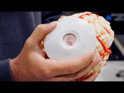 Thumbnail for Our First Transdural Procedure | Neuralink