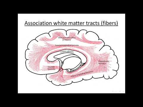 Thumbnail for Brain (2) Basal nuclei + white matter tracts + cerebrum